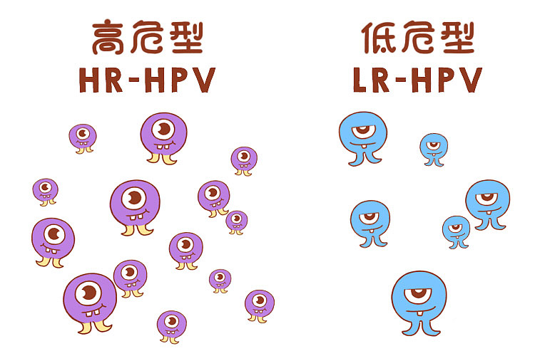 从HPV感染到宫颈癌，只有5步