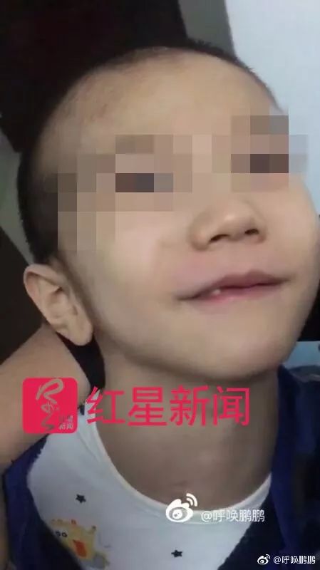 女童被砸伤，母亲抗诉被驳回，社会深思