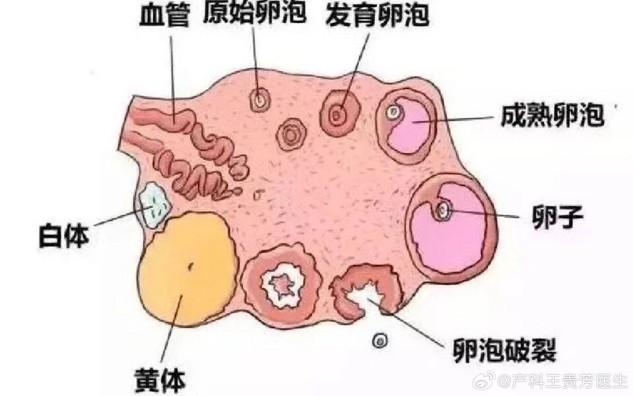 夫妻玩闹时妻子黄体破裂，了解这种妇科急症，妻子黄体破裂，夫妻玩闹时的意外，妇科急症，夫妻玩闹时妻子黄体破裂，夫妻玩闹时，妻子遭遇黄体破裂，黄体破裂，夫妻玩闹时的风险