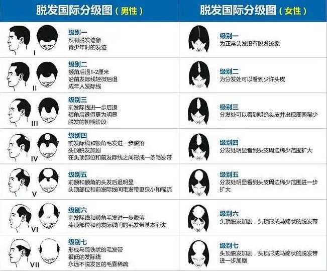 植发医院排名及其影响力深度解析