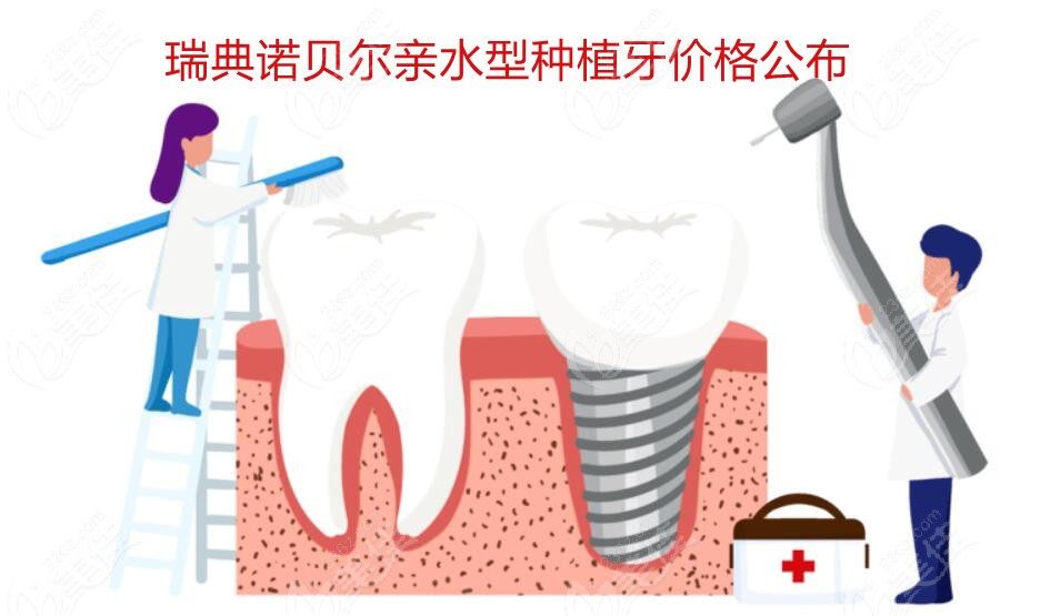 诺贝尔种植牙价格详解与全面指导手册